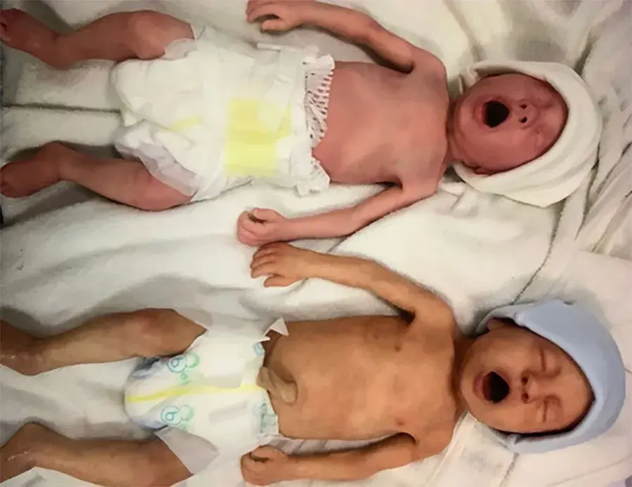 Lifecast Supports Neonatal Palliative and End of Life Care Simulation Course